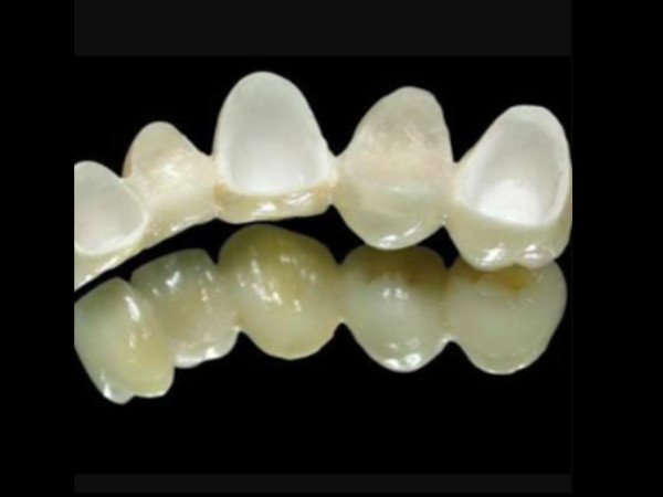 Zirconia Crowns