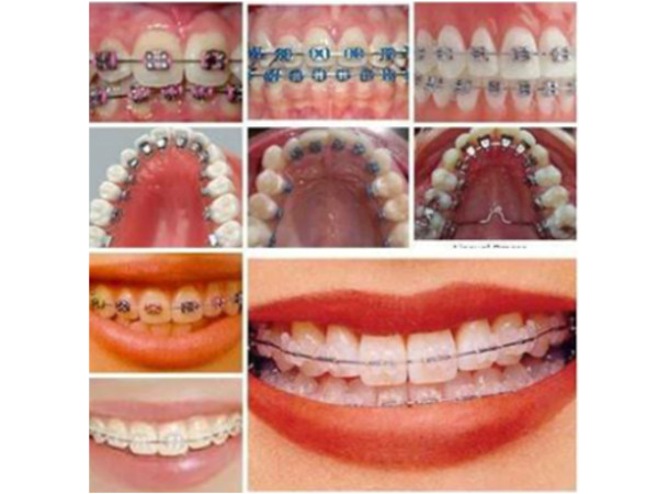 Orthodontics