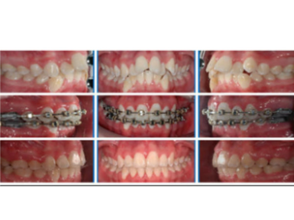 Orthodontics