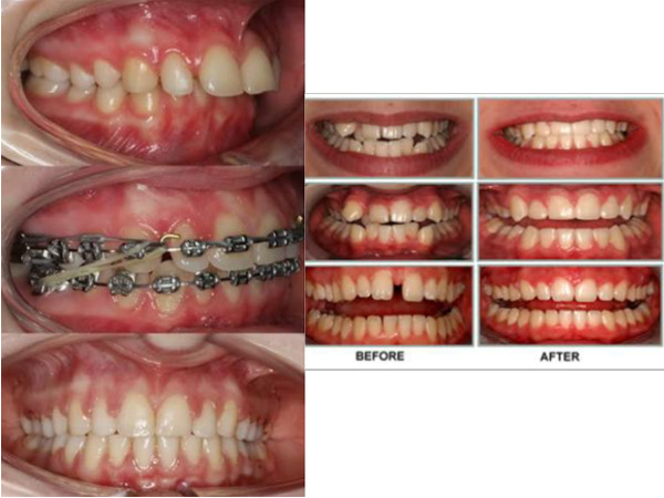 Orthodontics