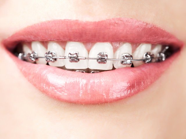 Orthodontics